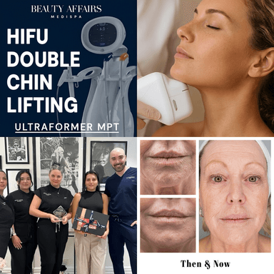 ALASTIN Venus Legacy Collagen Firm & Plump Restore - Sydney CBD