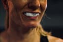Mouthguard Buying Guide: Sports vs. Night Guards